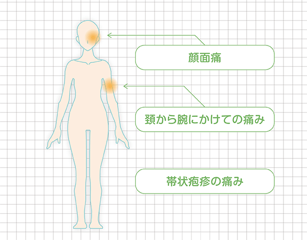 顔面痛・頚から腕にかけての痛み・帯状疱疹の痛み